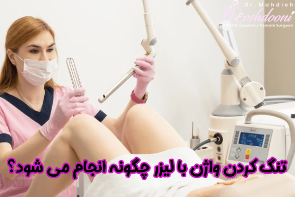 تنگ کردن واژن با لیزر چگونه انجام می شود