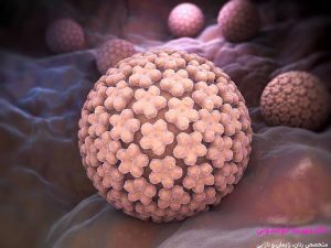 درمان زگیل تناسلی