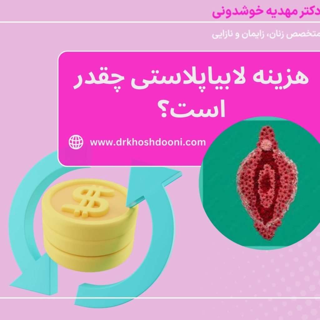 هزینه لابیاپلاستی