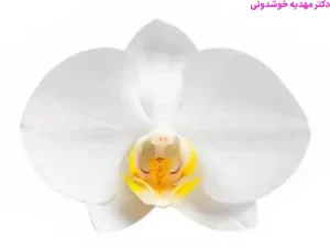 ماندگاری لابیاپلاستی