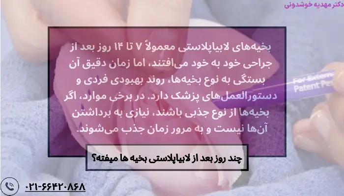 بخیه های لابیاپلاستی