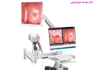 تفسیر جواب کولپوسکوپی