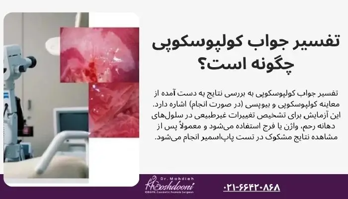 تفسیر جواب کولپوسکوپی