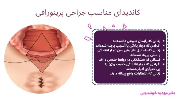 کاندیدای مناسب جراحی پرینورافی