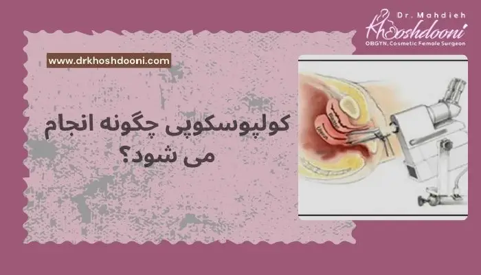 کولپوسکوپی