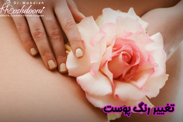 تغییر رنگ پوست