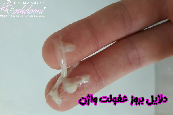 دلایل بروز عفونت واژن