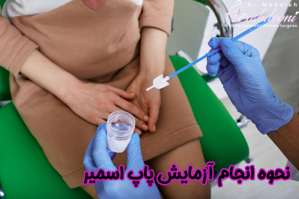 نحوه انجام آزمایش پاپ اسمیر