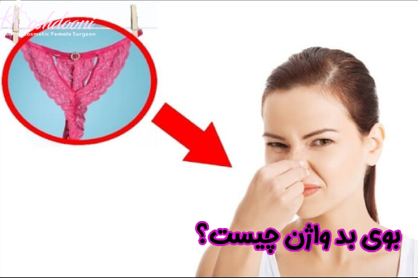بوی بد واژن چیست