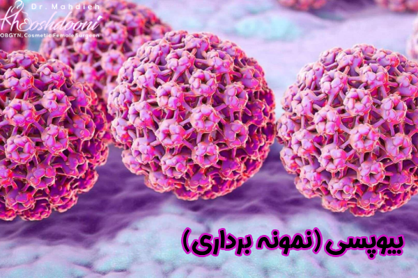 بیوپسی (نمونه برداری)