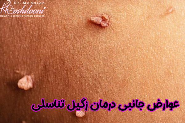 عوارض جانبی درمان زگیل تناسلی