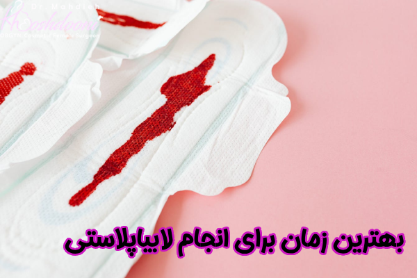 بهترین زمان برای انجام لابیاپلاستی