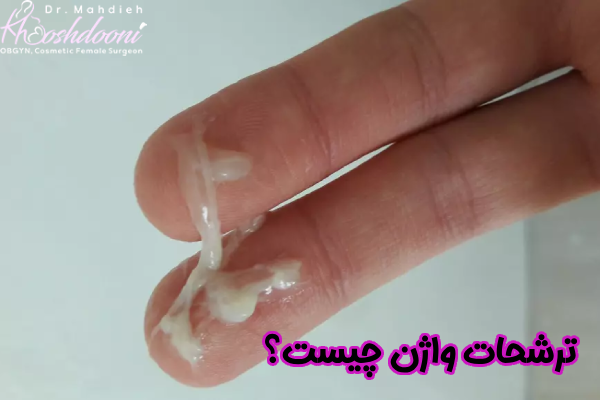 ترشحات واژن چیست