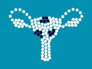 قرص برای فیبروم رحم