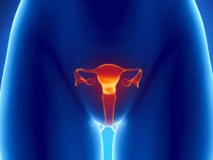 پیشگیری از فیبروم رحم