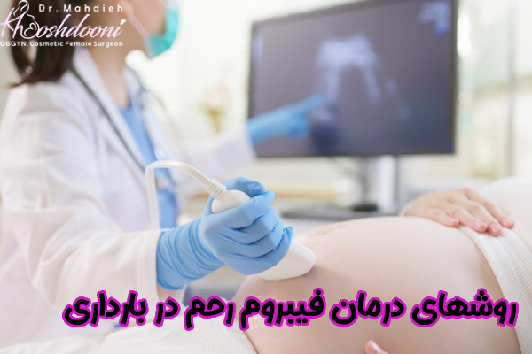 درمان فیبروم رحم در بارداری