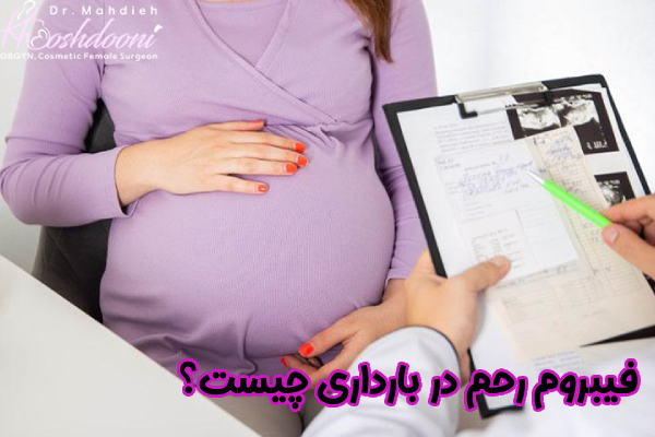 فیبروم رحم در بارداری چیست؟