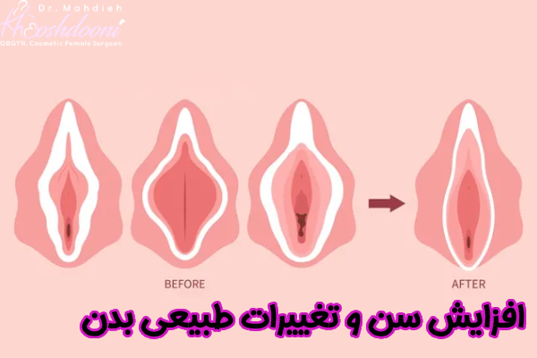 افزایش سن و تغییرات طبیعی بدن