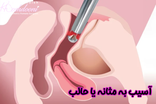 آسیب به مثانه یا حالب