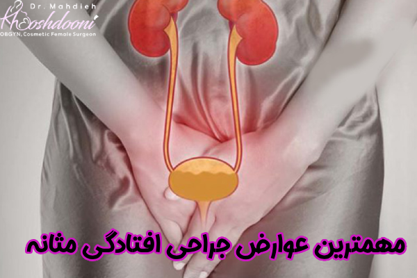 خطرات جراحی افتادگی مثانه