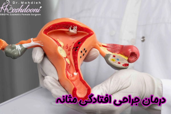 درمان جراحی افتادگی مثانه